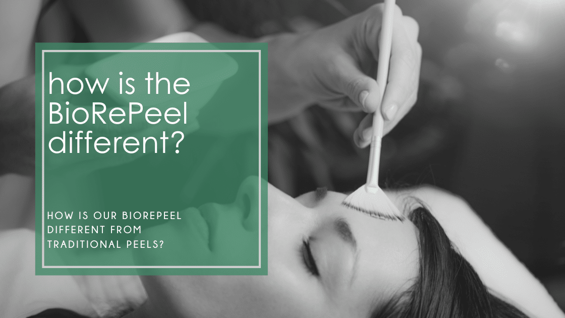 The BioRePeel uses a combination of natural acids, enzymes, peptides, and vitamins to exfoliate while removing impurities from the skin.