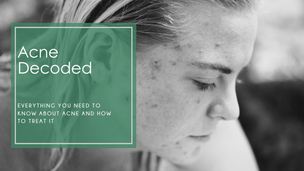 Acne: Your Guide To Clear Skin - Skin Deep Esthetics LLC