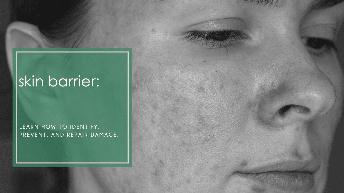 Learn how to identify, prevent, and repair damage. Get expert tips to restore healthy, radiant skin naturally.