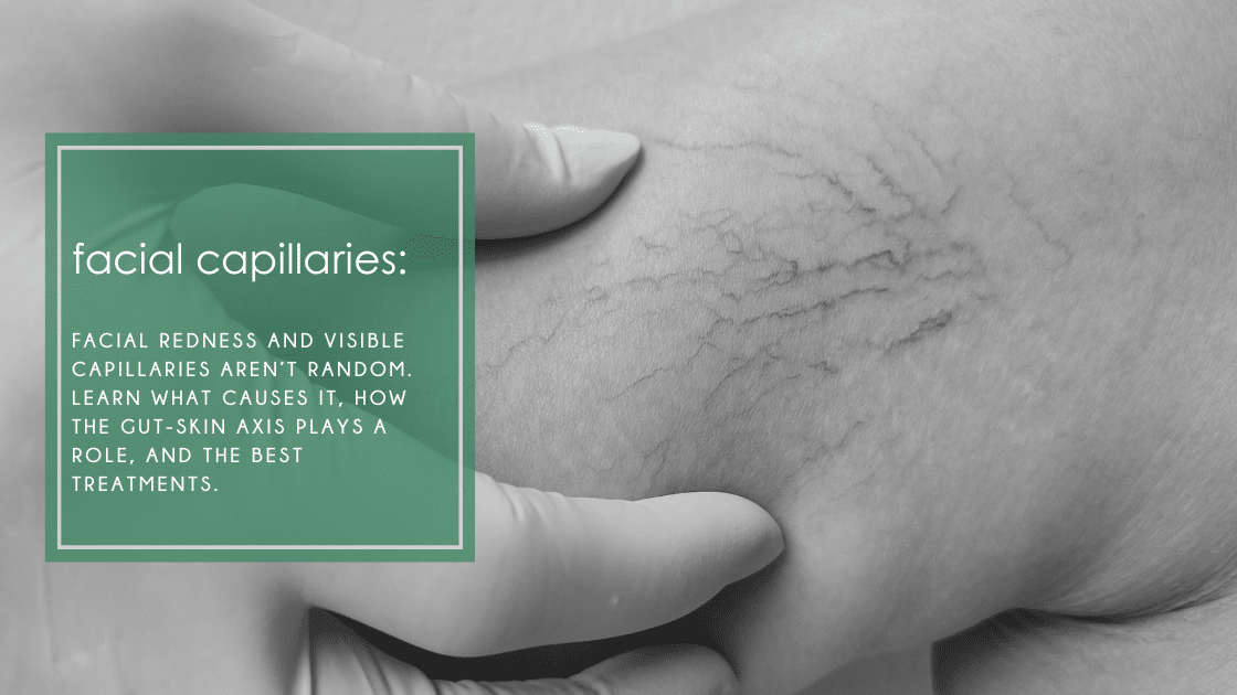 Facial redness and visible capillaries aren’t random. Learn what causes it, how the gut-skin axis plays a role, and the best treatments.
