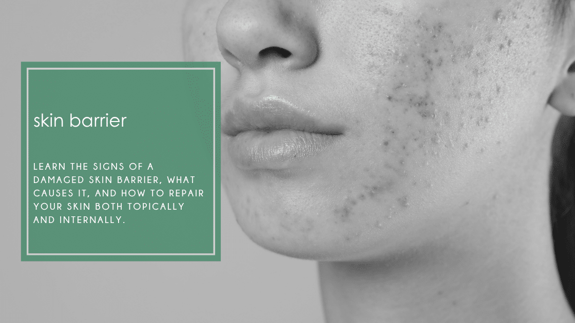 Learn the signs of a damaged skin barrier, what causes it, and how to repair your skin both topically and internally.