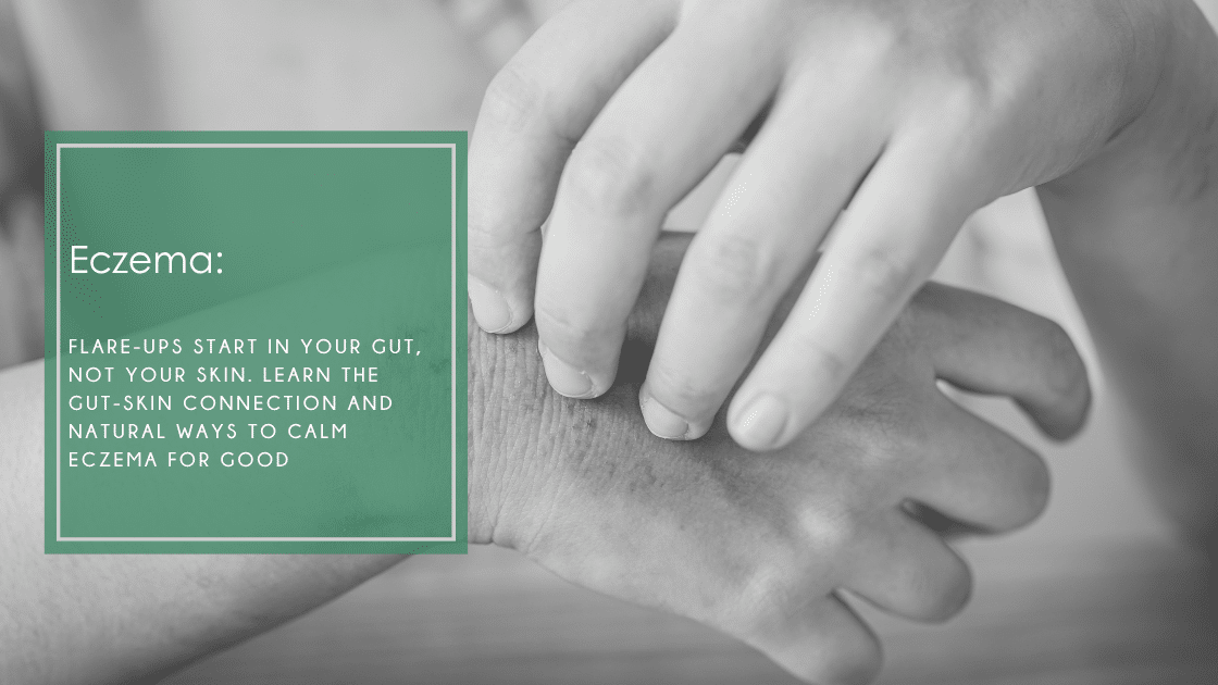 Eczema flare-ups may start in your gut, not your skin. Learn the gut-skin connection and natural ways to calm eczema for good