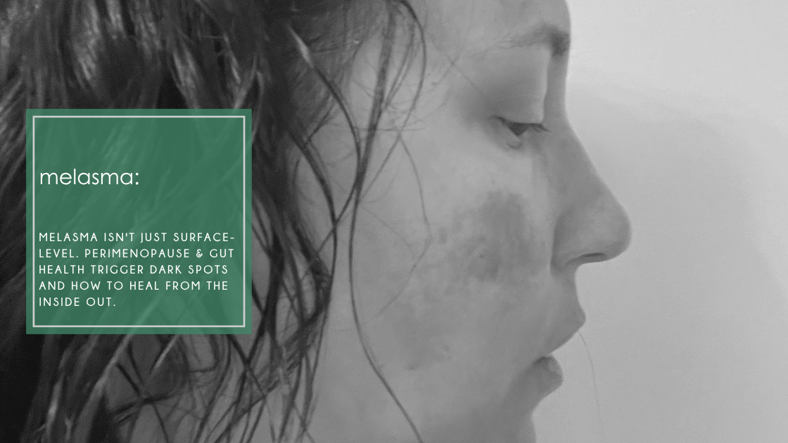 woman in her 40s dealing with perimenopause melasma